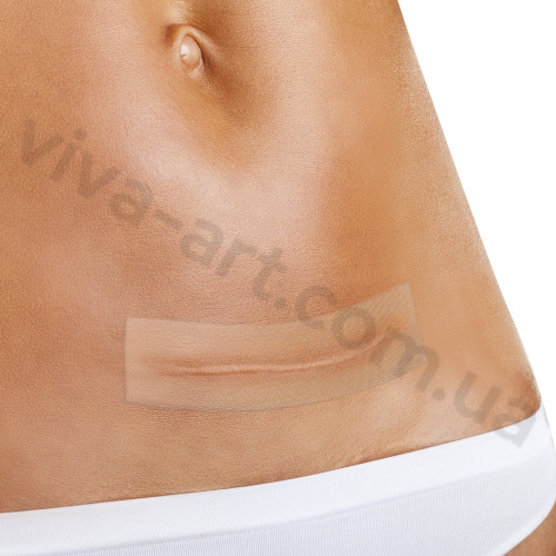 Силіконовий лист для лікування рубців, Fresco (Іспанія)